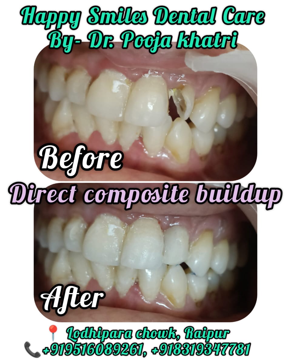 After Treatment